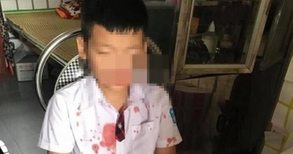 Phụ huynh đến trường thay con trai hành hung bạn sẽ phải ngồi tù bao lâu?