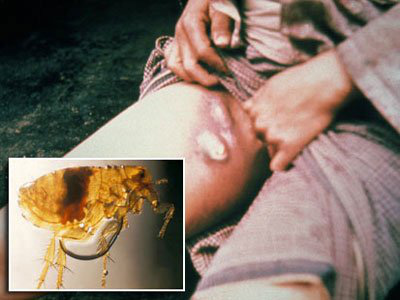 7 loại bệnh kinh khủng nhất mọi thời đại: Con người đành sống chung! - Ảnh 1.