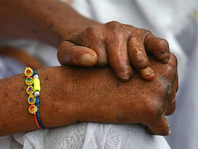 7 loại bệnh kinh khủng nhất mọi thời đại: Con người đành sống chung! - Ảnh 5.