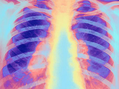 7 loại bệnh kinh khủng nhất mọi thời đại: Con người đành sống chung! - Ảnh 7.