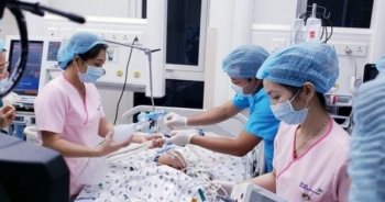 Cặp song sinh dính liền đã được đưa ra khỏi phòng mổ