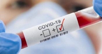 Thêm 1 bé gái nhiễm Covid-19 trên cùng chuyến bay từ Nga trở về