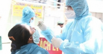 Tin Covid-19 sáng ngày 9/7: Thêm 425 ca mắc, TPHCM vẫn chiếm tỷ lệ cao với 350 ca