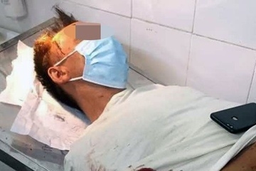 Nguyên nhân vụ vợ dùng dao chém chồng hàng chục nhát trong đêm tại Vĩnh Phúc