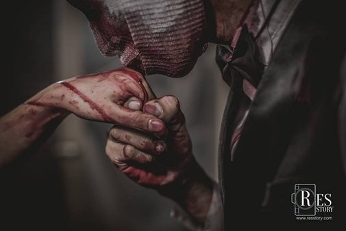 Rợn t&oacute;c g&aacute;y trước bộ ảnh cưới như phim kinh dị