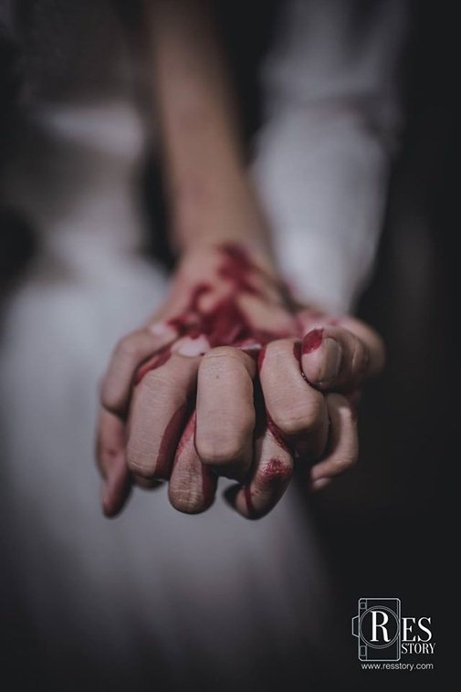 Rợn t&oacute;c g&aacute;y trước bộ ảnh cưới như phim kinh dị