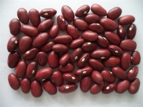 Đậu đỏ: Nhiều loại đậu c&oacute; chứa lectin nhưng h&agrave;m lượng cao nhất l&agrave; ở đậu đỏ. Chỉ cần ăn từ 4 - 5 hạt đậu đỏ sống l&agrave; c&oacute; thể bị đau bụng dữ dội, n&ocirc;n mửa, ti&ecirc;u chảy. Để loại bỏ lectin n&ecirc;n ng&acirc;m đậu &iacute;t nhất 5 tiếng trước khi nấu. Thời gian nấu đậu phải từ 10 ph&uacute;t trở l&ecirc;n, khi nấu để lửa to để loại bỏ độc tố.