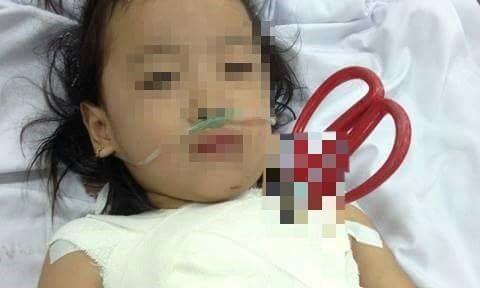 R&ugrave;ng m&igrave;nh c&acirc;y k&eacute;o vẫn tr&ecirc;n ngực b&eacute; g&aacute;i. Ảnh: Zing News