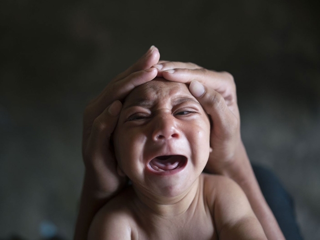 11 nước x&aacute;c nhận virus Zika lan truyền qua đường t&igrave;nh dục