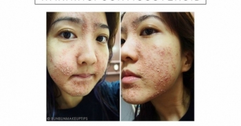 Mỹ phẩm nhau thai cừu phấn hoa NAK Q10 từng bị cơ quan chức năng phạt vì chưa công bố chất lượng sản phẩm