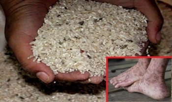 Chưa đủ căn cứ khẳng định “bệnh lạ” ở Quảng Ngãi là do gạo mốc
