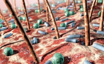 Tiềm ẩn nhiều nguy cơ bệnh tật từ mũ bảo hiểm