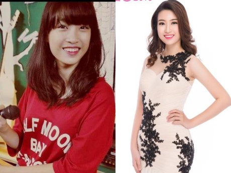 Facebooker chia sẻ bức ảnh được cho l&agrave; T&acirc;n Hoa hậu Đỗ Mỹ Linh với h&agrave;m răng k&eacute;m đẹp so với hiện tại.