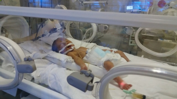 H&igrave;nh ảnh b&eacute; Gấu được chăm s&oacute;c đặc biệt tại bệnh viện. Ảnh: Giao th&ocirc;ng