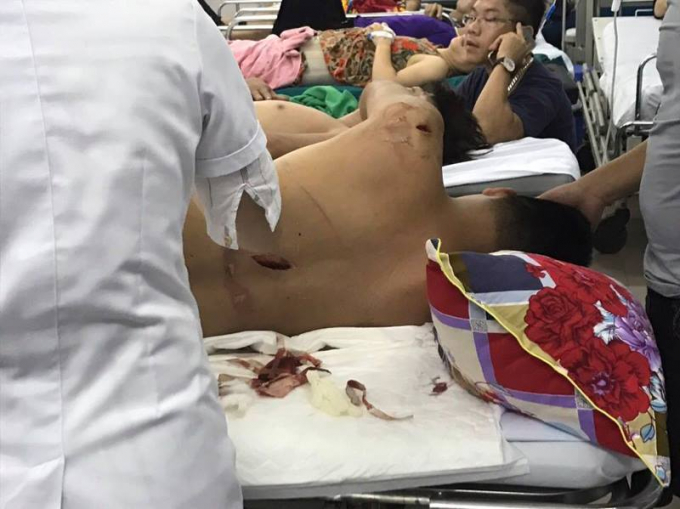 Nạm nh&acirc;n Đo&agrave;n Thanh Li&ecirc;m bị nhiều vết đ&acirc;m ch&eacute;m tr&ecirc;n người.