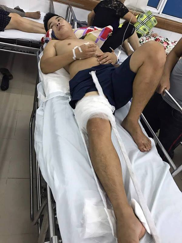 V&igrave; vết thương qu&aacute; nặng, nạn nh&acirc;n đ&atilde; được chuyển bệnh viện Việt Đức (H&agrave; Nội) trong đ&ecirc;m.