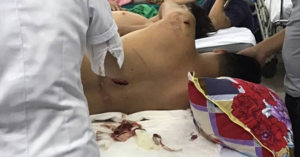 Hà Tĩnh: Nhóm côn đồ bịt mặt dùng kiếm truy sát nam thanh niên