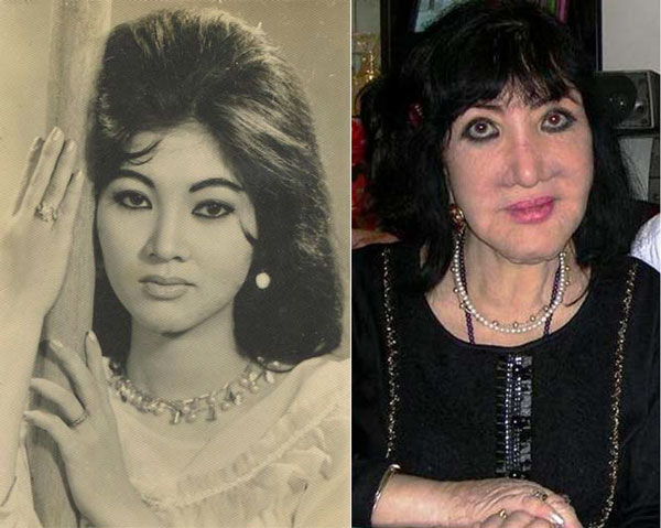 Tuyệt sắc giai nh&acirc;n một thời, minh tinh Thẩm Th&uacute;y Hằng v&agrave; h&igrave;nh ảnh khi về gi&agrave; với nhiều biến chứng sau phẫu thuật thẩm mỹ...