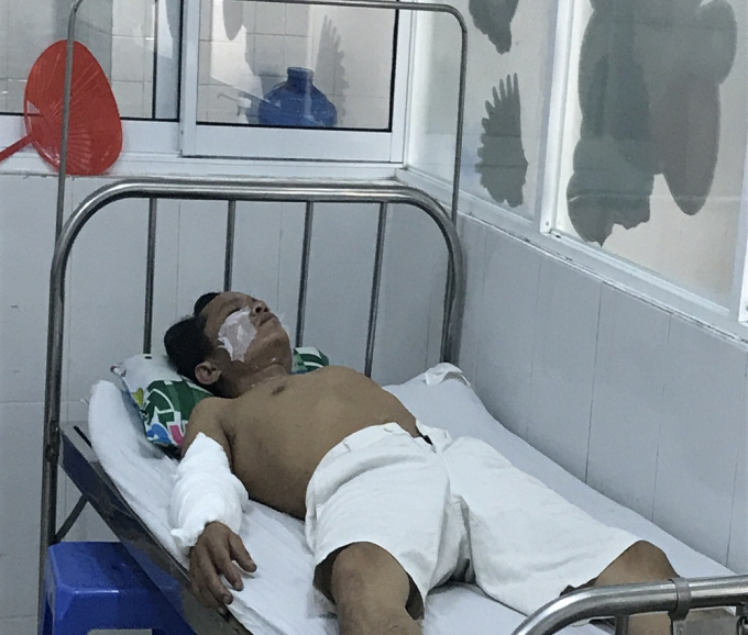 Một trong 4 c&ocirc;ng nh&acirc;n đang nằm điều trị tại bệnh viện. Ảnh: TT.