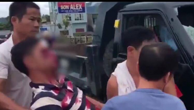 Người đ&agrave;n &ocirc;ng bị n&eacute;m v&agrave;o mắt. &nbsp;(Ảnh: Cắt từ clip).&nbsp;