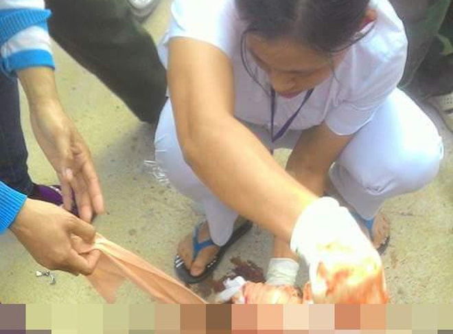 Nh&acirc;n vi&ecirc;n y tế đang kiểm tra thi thể Hiền Mi&ecirc;n.