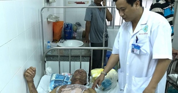 11 người phải nhập viện do bỏng ở tiệc cưới ở Cần Thơ