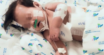 Sốc: Bé gái 10 tháng tuổi thủng thực quản, phổi kháng tất cả kháng sinh
