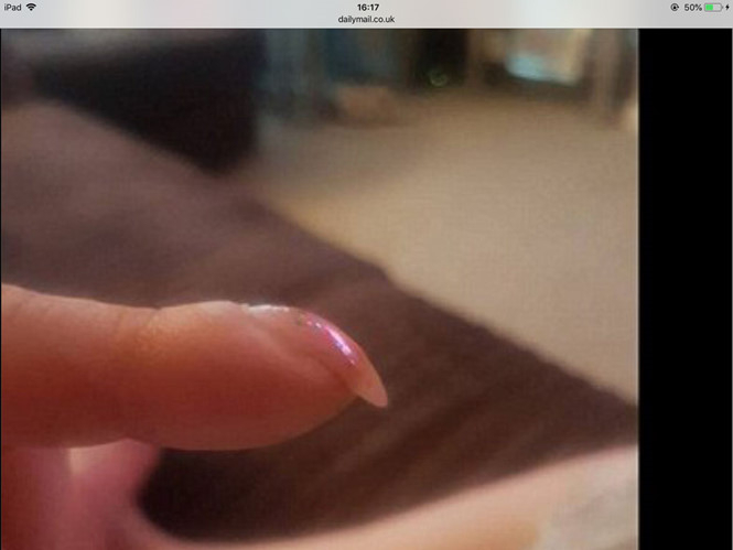 M&oacute;ng tay của b&agrave; Jean Taylor cong quặp xuống, một dấu hiệu của ung thư phổi. (Ảnh: Chụp từ m&agrave;n h&igrave;nh Daily Mail)