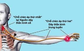 Dễ dàng ngừa tránh "liệt tối thứ Bảy"!