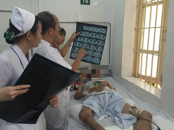 PGS.TS Đỗ Duy Cường, Trưởng khoa Nhi&ecirc;̃m Khu&acirc;̉n, B&ecirc;̣nh vi&ecirc;̣n Bạch Ma thăm khám b&ecirc;̣nh nh&acirc;n. Ảnh: BVCC