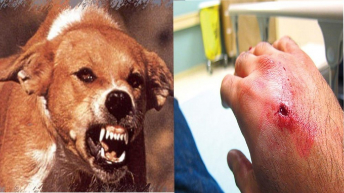 Người d&acirc;n khi bị ch&oacute; m&egrave;o nghi dại cắn cần được đến c&aacute;c cơ sở y tế để được kh&aacute;m, tư vấn v&agrave; ti&ecirc;m ph&ograve;ng sớm.