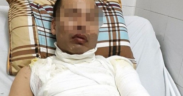 Hà Nội: Điều tra vụ người đàn ông bị tạt axit giữa phố