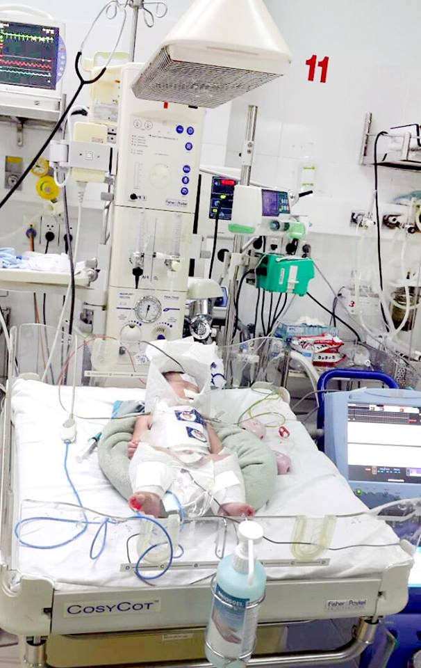 B&eacute; trai may mắn được cứu sống. Ảnh: BVCC