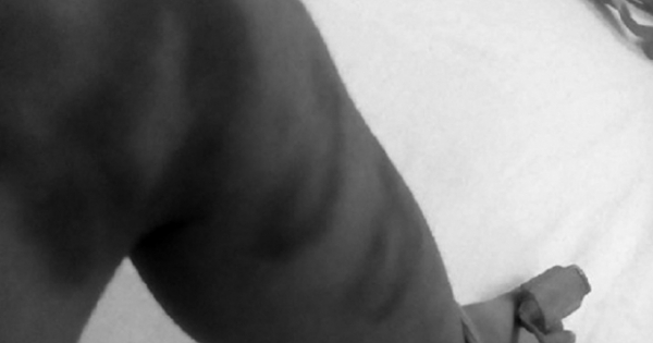 Nghi án cháu bé 5 tuổi bị người tình của mẹ đánh nhập viện