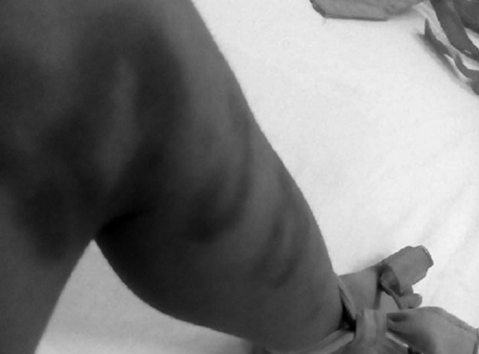 Ch&aacute;u H&ugrave;ng nghi bị người t&igrave;nh của mẹ bạo h&agrave;nh.