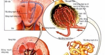 Nhận biết bệnh thận mạn để kịp thời chữa trị