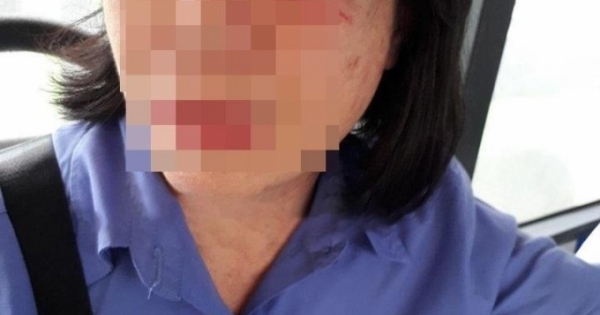 Công an vào cuộc điều tra vụ tiếp viên xe buýt bị đánh