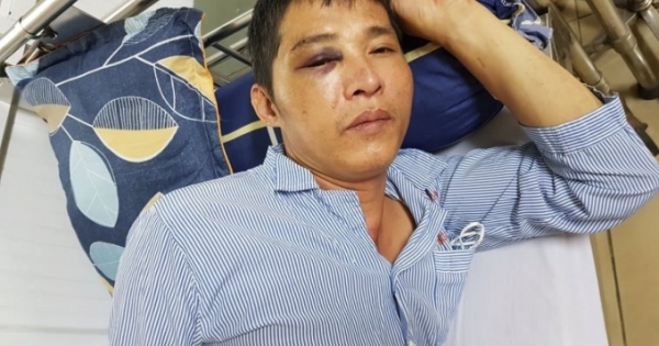 Chương Mỹ (Hà Nội): Cần làm rõ đối tượng cầm đầu, hành hung gây tổn hại sức khỏe cho người khác 50%?