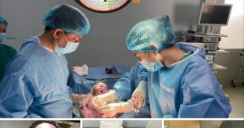 Thực hư chuyện bác sĩ rút ống thở của mẹ để cứu sản phụ sắp sinh