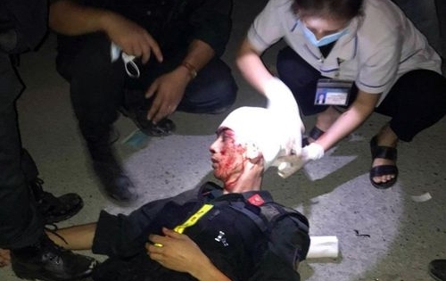 Chiến sĩ công an bị đối tượng quá khích tấn công gây thương tích