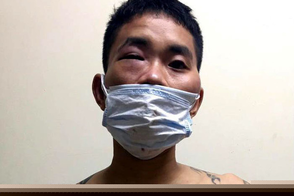 Nam thanh niên bị tạm giữ