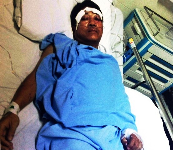 Bị hại&nbsp;Nguyễn Hữu Ho&agrave;ng khi đang điều trị tại Bệnh viện. (Ảnh: anh Ho&agrave;ng cung cấp)