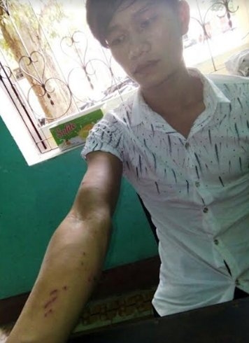 D&ugrave; bị chống trả quyết liệt, đối tượng vẫn thực hiện h&agrave;nh vi đồi bại.