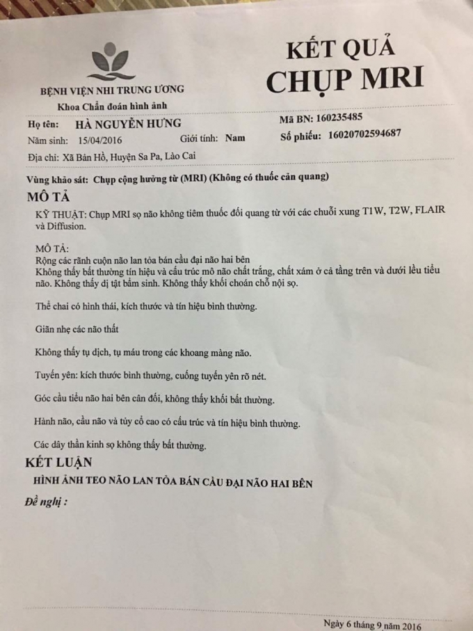 Kết quả chụp MRI cho thấy ch&aacute;u b&eacute; kh&ocirc;ng bị bại n&atilde;o bẩm sinh.