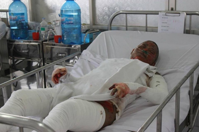 T&igrave;nh trạng sức khỏe chị H. đang rất xấu.