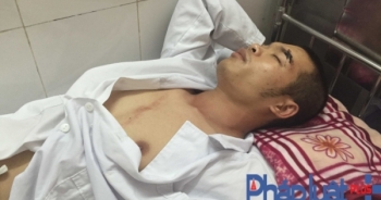 Người dân tố bị nhà xe đánh trọng thương