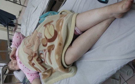 C&ocirc; g&aacute;i trẻ bị b&eacute;o ph&igrave; v&agrave; tiểu đường điều trị tại bệnh viện Nội tiết Trung ương.&nbsp;Ảnh: T.Hạnh