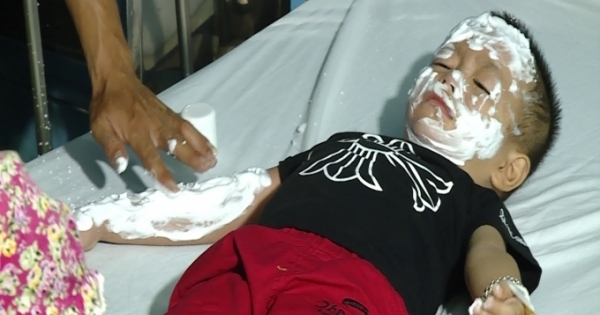 Quảng Bình: Bóng bay bất ngờ phát nổ làm 9 người bị thương