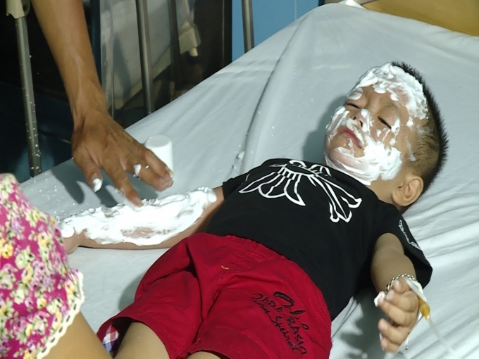 Một trong những nạn nh&acirc;n đang điều trị tại Bệnh viện Cu ba - Đồng Hới.