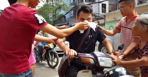 Hà Nội: Nam thanh niên bị thanh sắt đập trúng mặt phải nhập viện cấp cứu